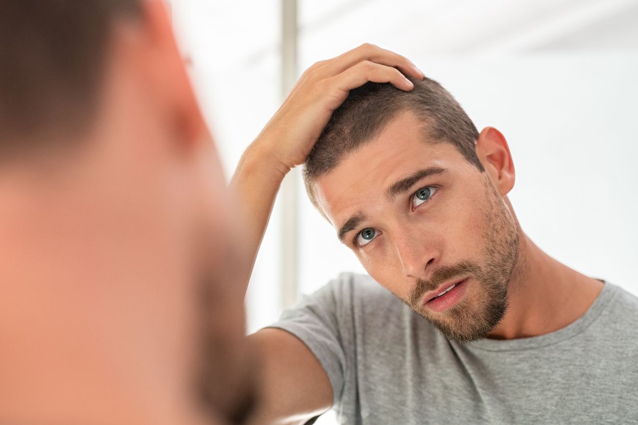 Finasteride contra el al·lopècia