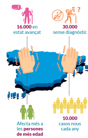 Parkinson Parkinson