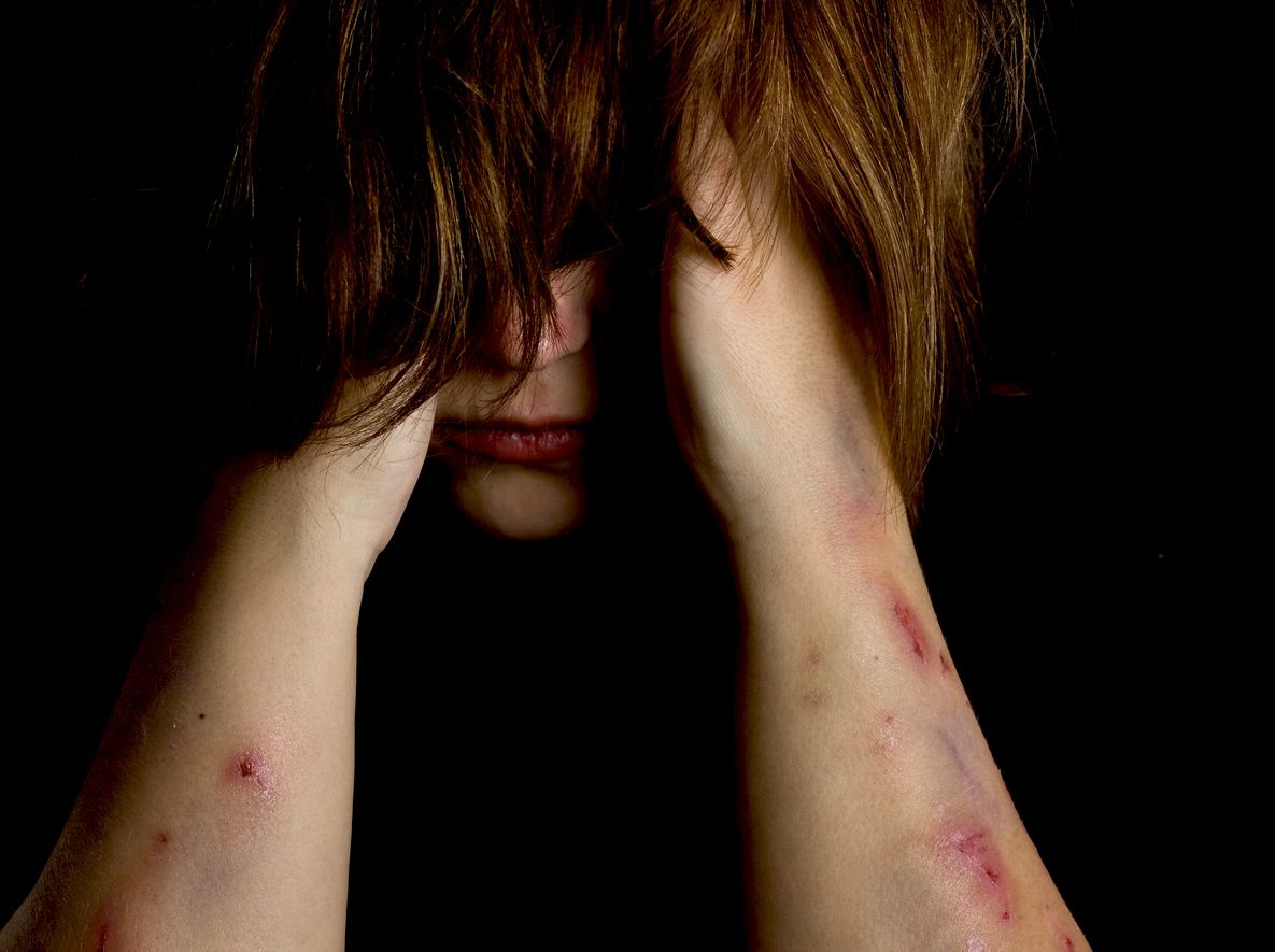 autolesions