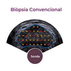 Centro Diagnostico Alomar Biopsia Convencional Centro Diagnostico Alomar Biopsia Convencional