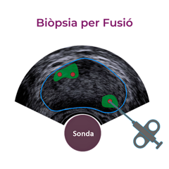 Centro Diagnostico Alomar Biopsia Fusion Centro Diagnostico Alomar Biopsia Fusion
