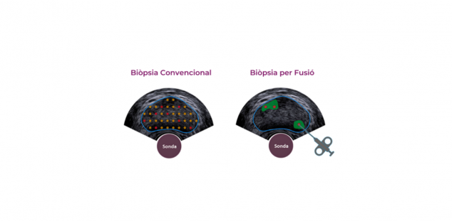 Biopsia Biopsia