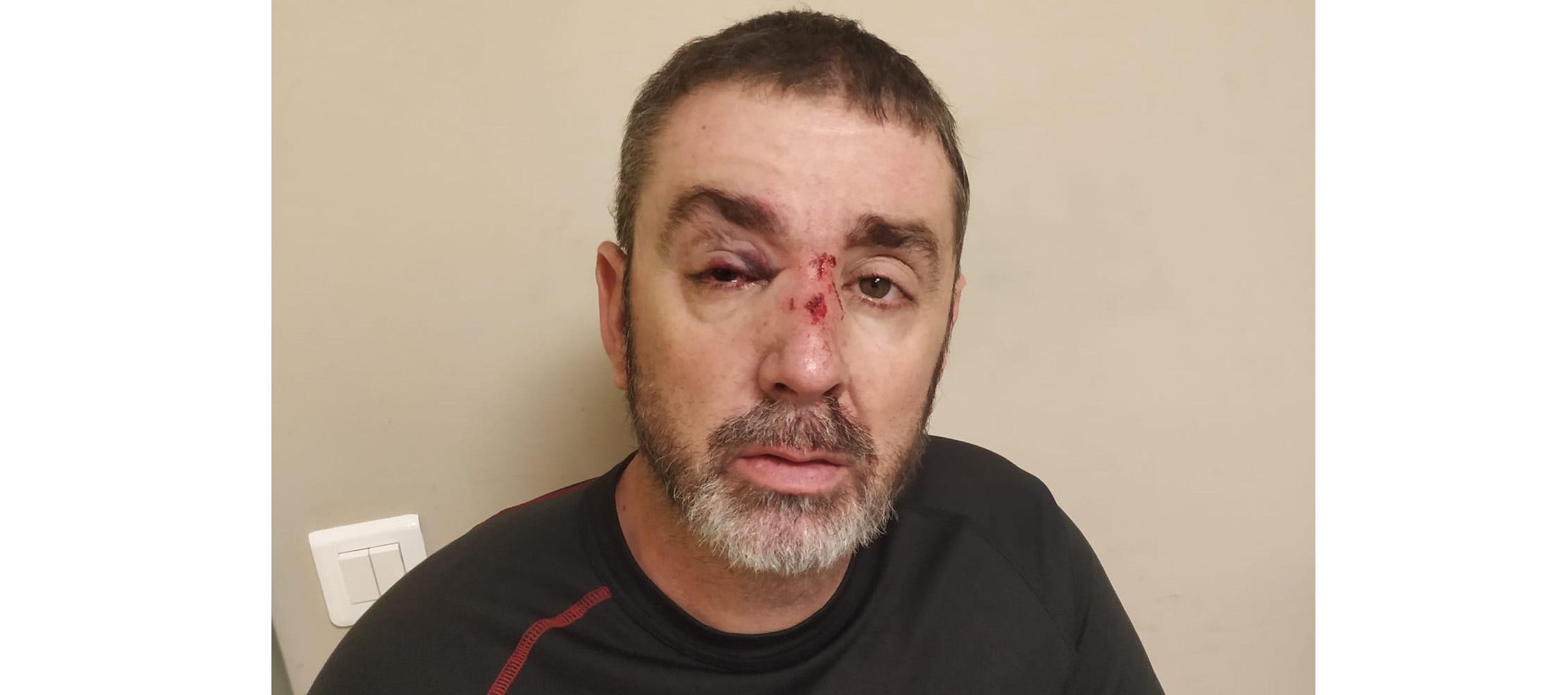 Uno de los vigilantes de seguridad agredidos en Pineda