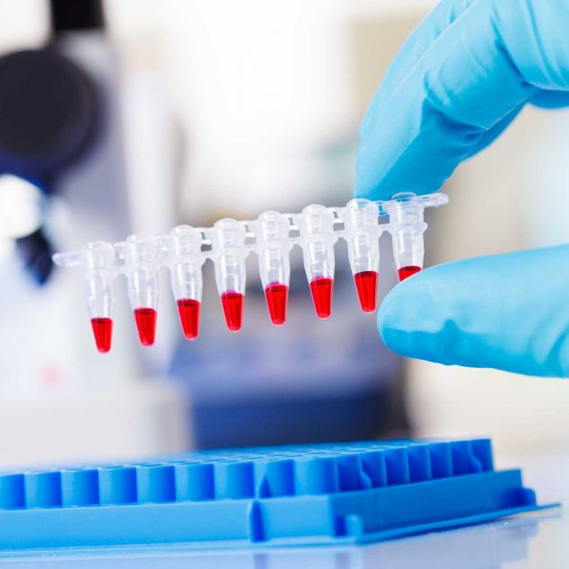 Imatge d'arxiu d'un test PCR dels que validen els casos confirmats de covid-19 Imatge d'arxiu d'un test PCR dels que validen els casos confirmats de covid-19